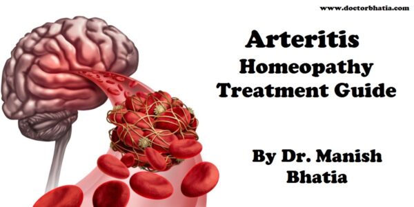 Arteritis Homeopathy Treatment And Homeopathic Remedies Doctor Bhatias Asha Homeopathy 2215